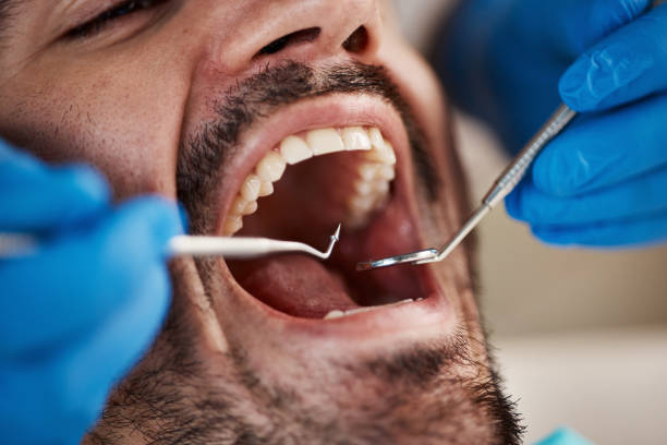 Best Dentist for Tooth Abscess  in Farmington, MN